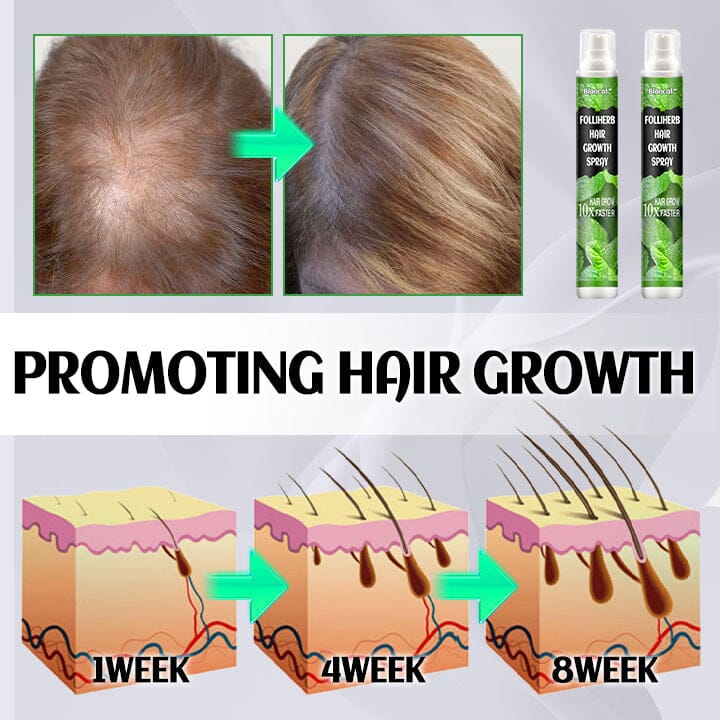 Biancat™ FolliHerb Hair Growth Spray English SLJM 