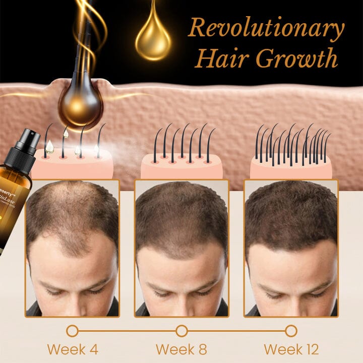 Ceoerty™ BiotinLuxe Hair Growth Essence Spray English ERUN 